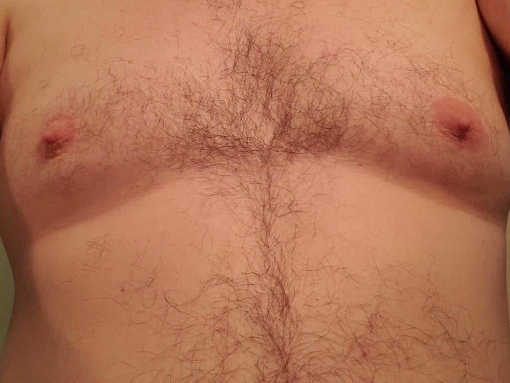 slut hairy upper chest 1/9/20