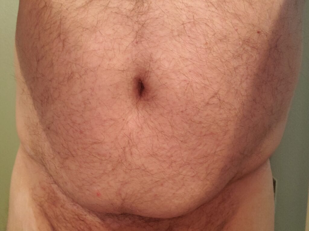 slut hairy belly/abdomen 1/9/20