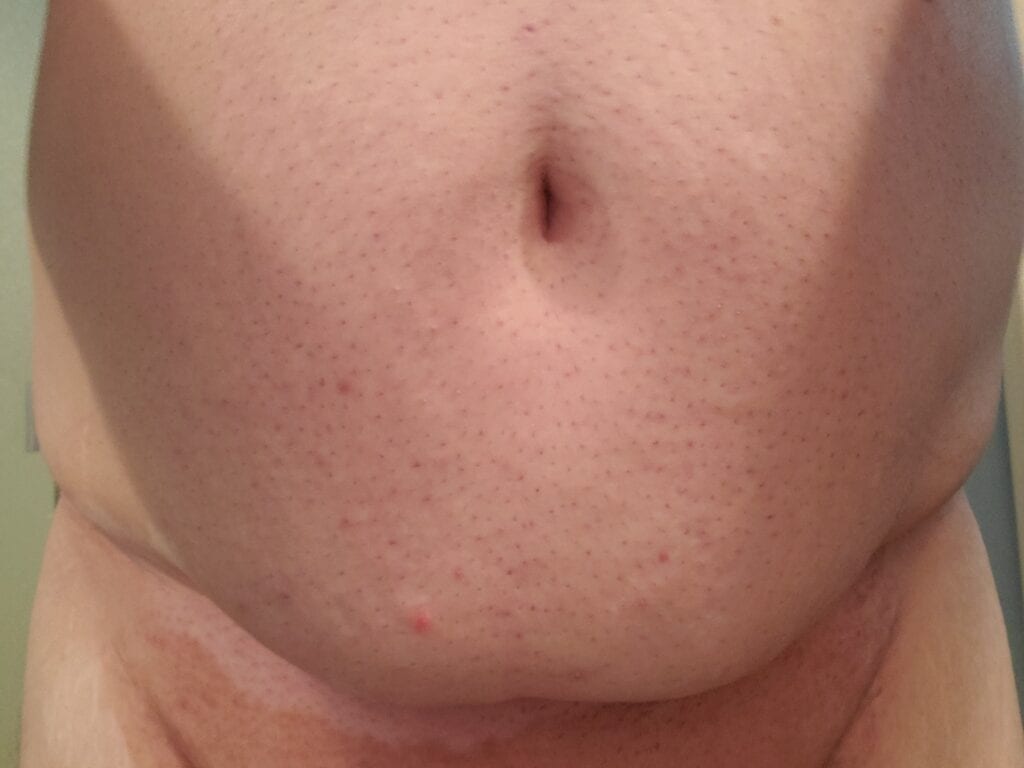 little boi slut shaved belly/abdomen 1/9/21