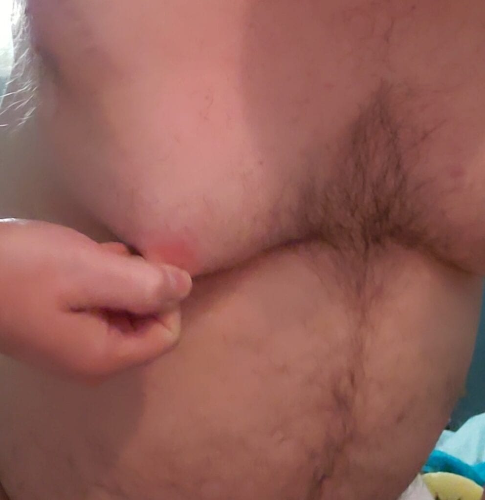 Post Nipple Torture
